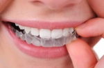 Aligner Innovations: What Dubai Residents Need to Know