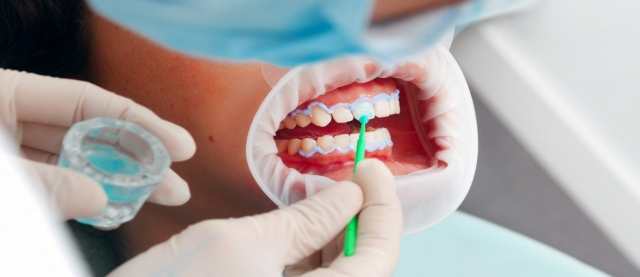 Preventive to Restorative: A Holistic Look at General Dentistry in Dubai